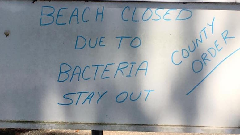 Beach closed